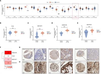 Unraveling the role of Major Vault Protein as a novel immune-related biomarker that promotes the proliferation and migration in pancreatic adenocarcinoma